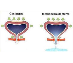 continenza incontinenza